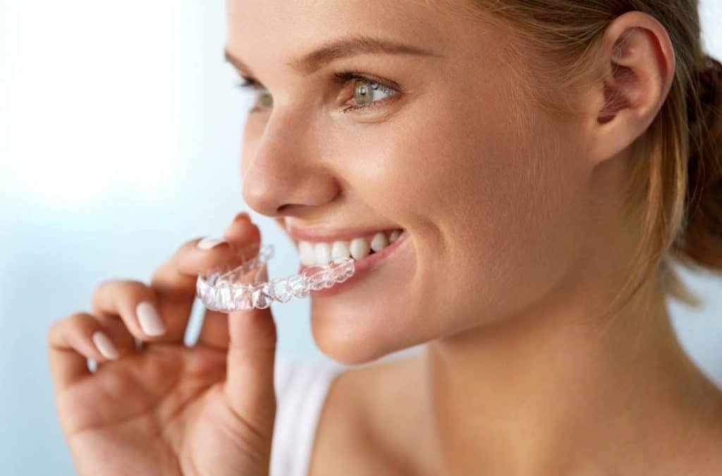 Invisalign Clapham 