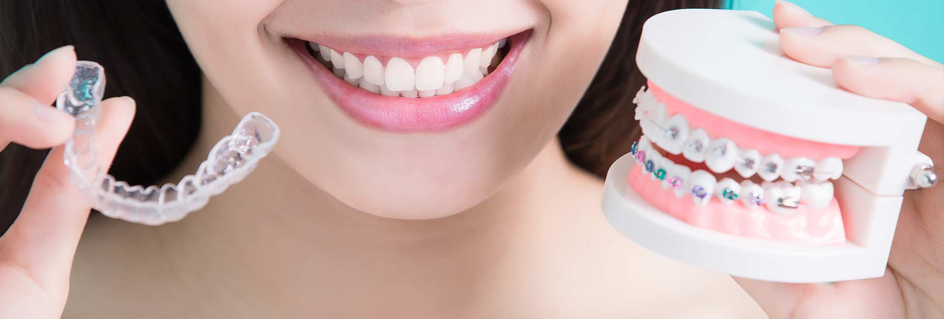 How Invisalign in Clapham Is Transforming Smiles Discreetly